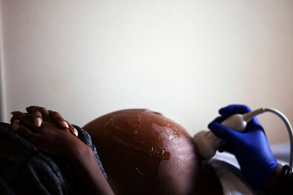 Ultrasound department